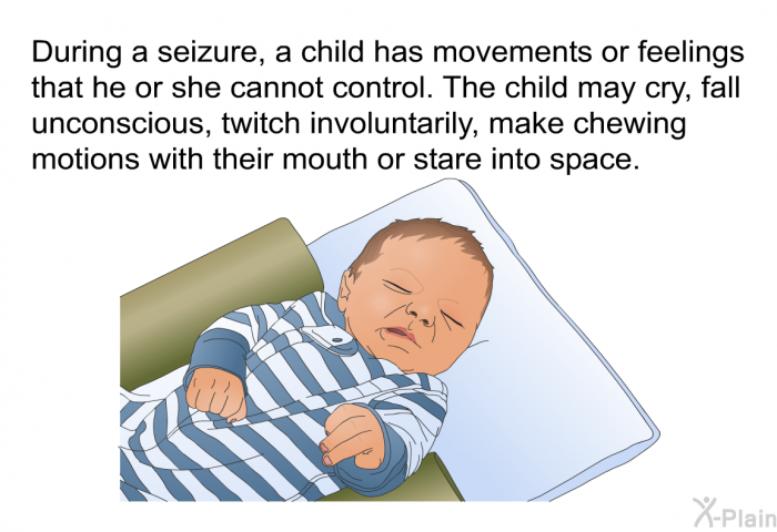 During a seizure, a child has movements or feelings that he or she cannot control. The child may cry, fall unconscious, twitch involuntarily, make chewing motions with their mouth or stare into space.