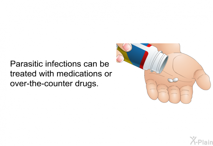 Parasitic infections can be treated with medications or over-the-counter drugs.