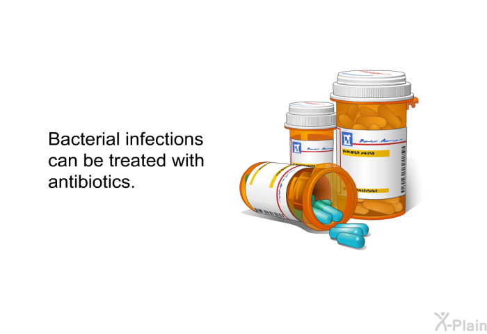 Bacterial infections can be treated with antibiotics.