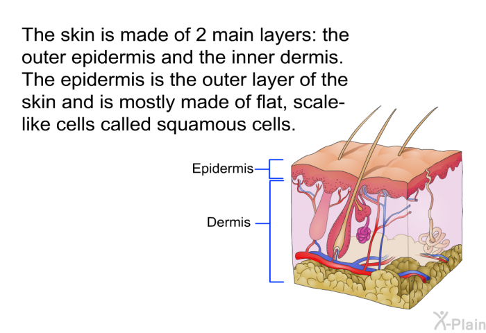 The skin is made of 2 main layers: the outer epidermis and the inner dermis. The epidermis is the outer layer of the skin and is mostly made of flat, scale-like cells called squamous cells.