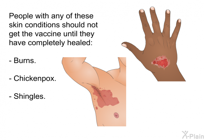 People with any of these skin conditions should not get the vaccine until they have completely healed:  Burns. Chickenpox. Shingles.