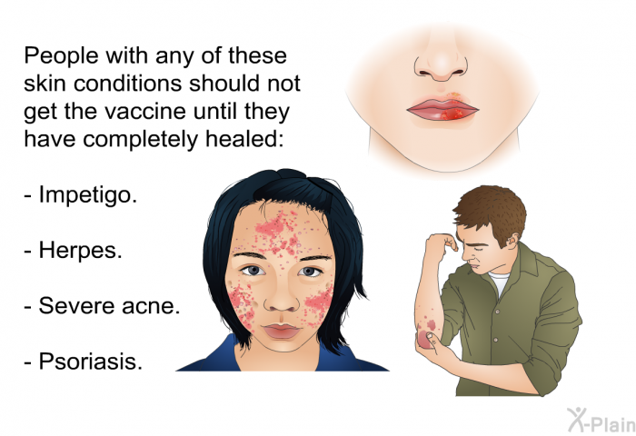 People with any of these skin conditions should not get the vaccine until they have completely healed:  Impetigo. Herpes. Severe acne. Psoriasis.