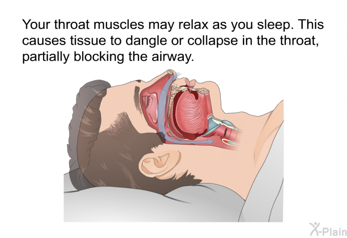 Your throat muscles may relax as you sleep. This causes tissue to dangle or collapse in the throat, partially blocking the airway.