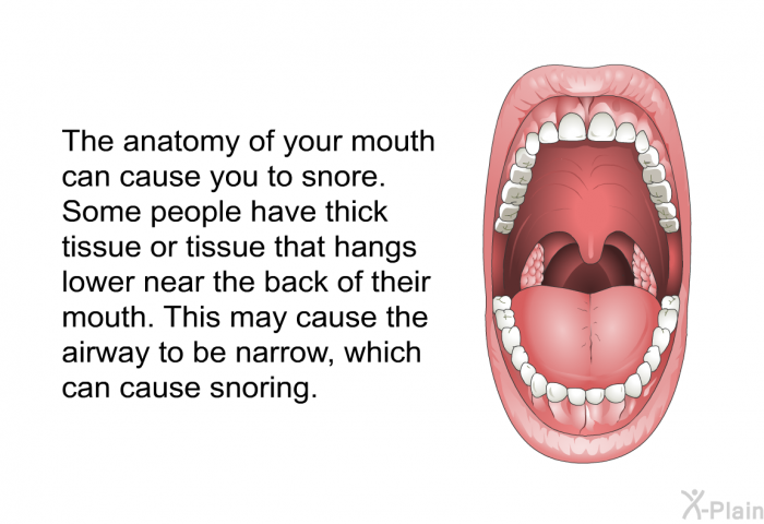 The anatomy of your mouth can cause you to snore. Some people have thick tissue or tissue that hangs lower near the back of their mouth. This may cause the airway to be narrow, which can cause snoring.