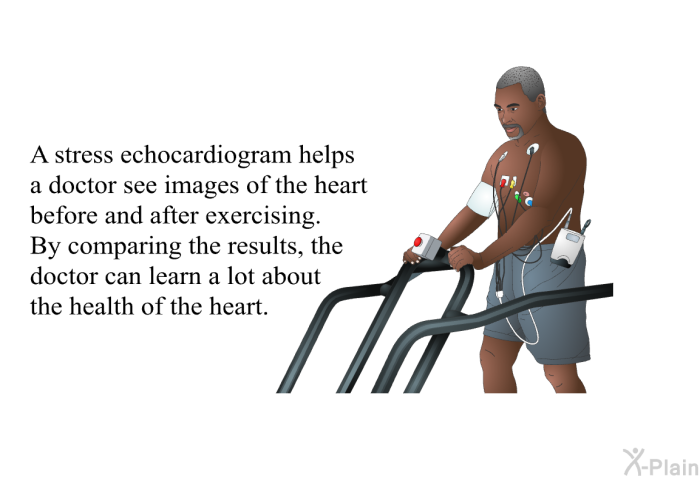 A stress echocardiogram helps a doctor see images of the heart before and after exercising. By comparing the results, the doctor can learn a lot about the health of the heart.