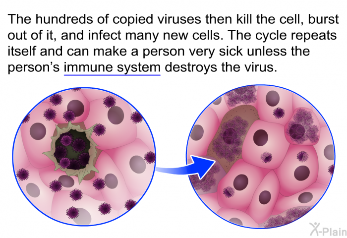 The hundreds of copied viruses then kill the cell, burst out of it, and infect many new cells. The cycle repeats itself and can make a person very sick unless the person's immune system destroys the virus.