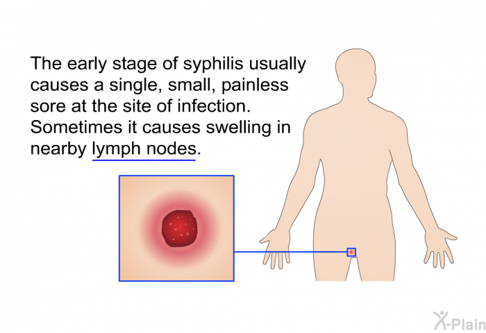 The early stage of syphilis usually causes a single, small, painless sore at the site of infection. Sometimes it causes swelling in nearby lymph nodes.