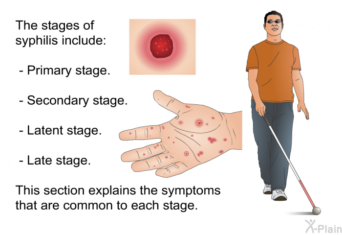 The stages of syphilis include:  Primary stage. Secondary stage. Latent stage. Late stage.  
 This section explains the symptoms that are common to each stage.