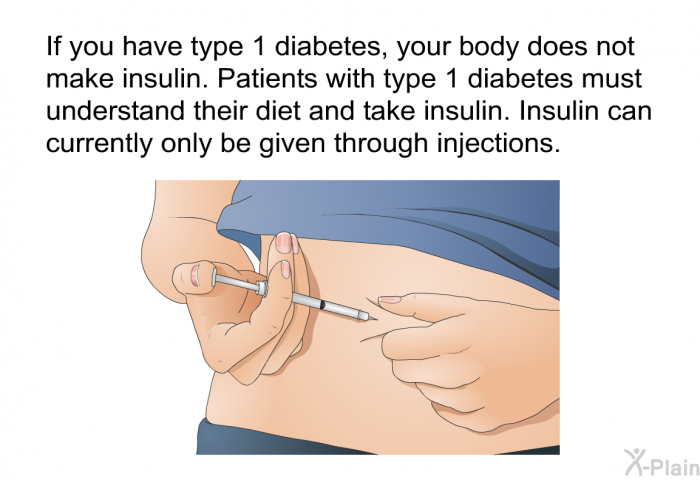 If you have type 1 diabetes, your body does not make insulin. Patients with type 1 diabetes must understand their diet and take insulin. Insulin can currently only be given through injections.
