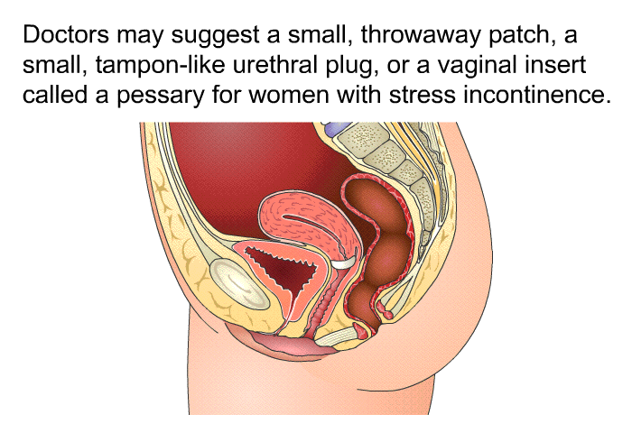 Doctors may suggest a small, throwaway <I>patch</I>, a small, tampon-like <I>urethral plug</I>, or a vaginal insert called a <I>pessary </I>for women with stress incontinence.