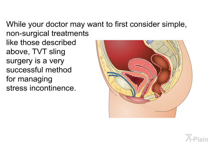 While your doctor may want to first consider simple, non-surgical treatments like those described above, TVT sling surgery is a very successful method for managing stress incontinence.