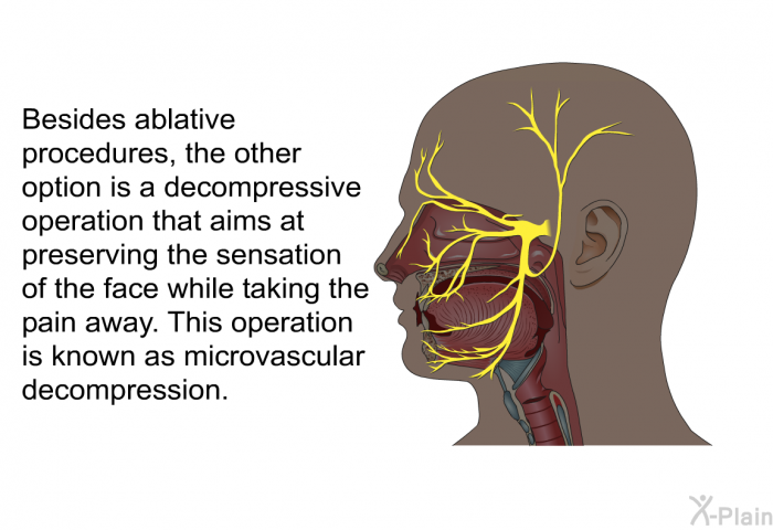 Besides ablative procedures, the other option is a decompressive operation that aims at preserving the sensation of the face while taking the pain away. This operation is known as microvascular decompression.