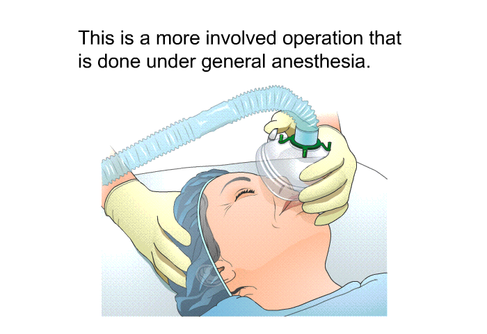 This is a more involved operation that is done under general anesthesia.