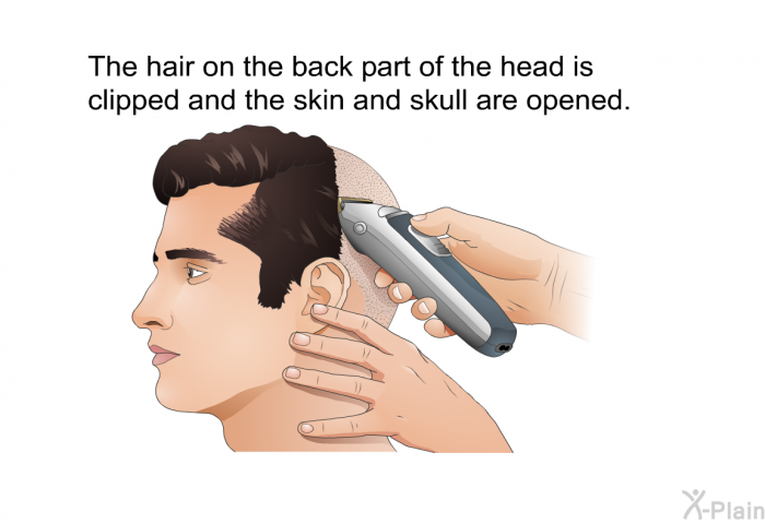 The hair on the back part of the head is clipped and the skin and skull are opened.