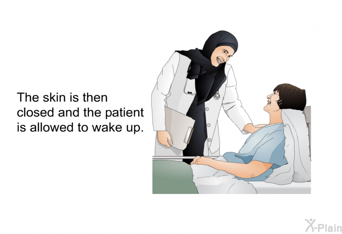 The skin is then closed and the patient is allowed to wake up.
