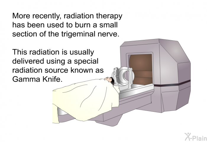 More recently, radiation therapy has been used to burn a small section of the trigeminal nerve. This radiation is usually delivered using a special radiation source known as Gamma Knife.