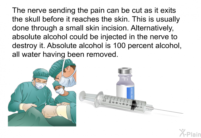 The nerve sending the pain can be cut as it exits the skull before it reaches the skin. This is usually done through a small skin incision. Alternatively, absolute alcohol could be injected in the nerve to destroy it. Absolute alcohol is 100 percent alcohol, all water having been removed.