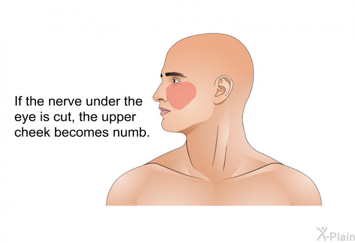 If the nerve under the eye is cut, the upper cheek becomes numb.