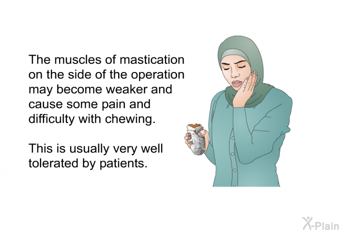 The muscles of mastication on the side of the operation may become weaker and cause some pain and difficulty with chewing. This is usually very well tolerated by patients.