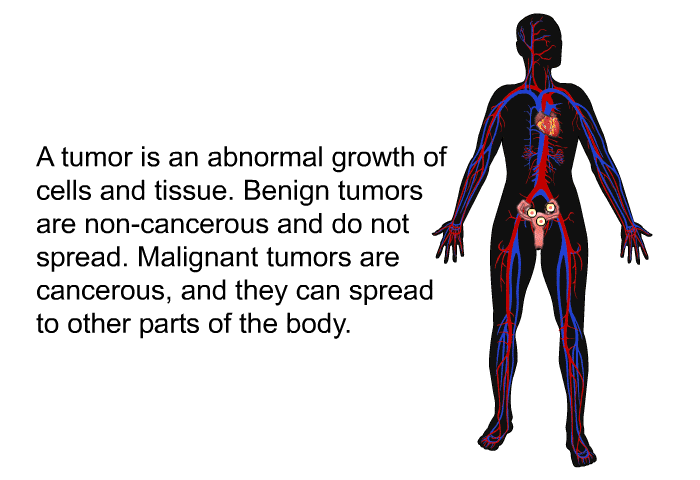 A tumor is an abnormal growth of cells and tissue. Benign tumors are non-cancerous and do not spread. Malignant tumors are cancerous, and they can spread to other parts of the body.