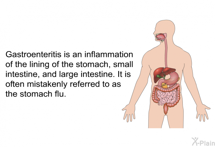 Gastroenteritis is an inflammation of the lining of the stomach, small intestine, and large intestine. It is often mistakenly referred to as the stomach flu.