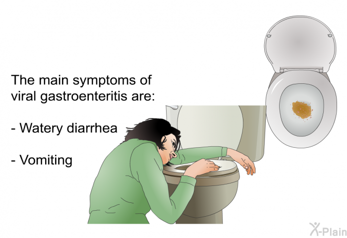 The main symptoms of viral gastroenteritis are:  Watery diarrhea Vomiting