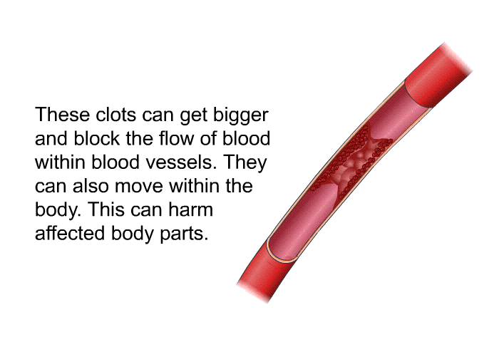 These clots can get bigger and block the flow of blood within blood vessels. They can also move within the body. This can harm affected body parts.