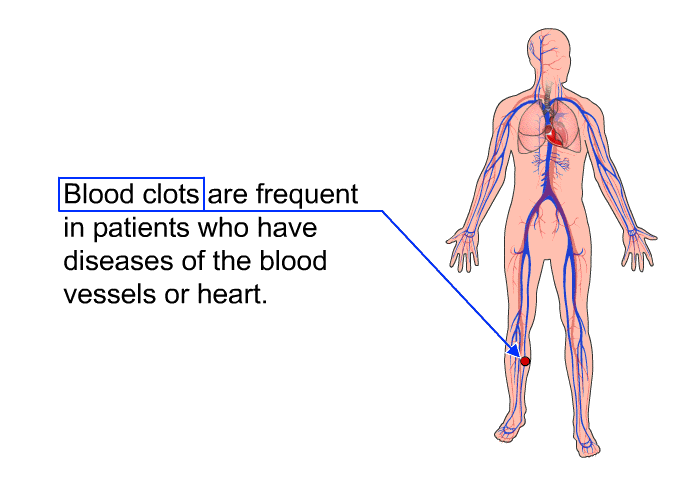 Blood clots are frequent in patients who have diseases of the blood vessels or heart.