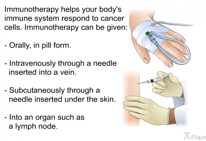 Immunotherapy helps your body's immune system respond to cancer cells. Immunotherapy can be given:  Orally, in pill form. Intravenously through a needle inserted into a vein. Subcutaneously through a needle inserted under the skin. Into an organ such as a lymph node.