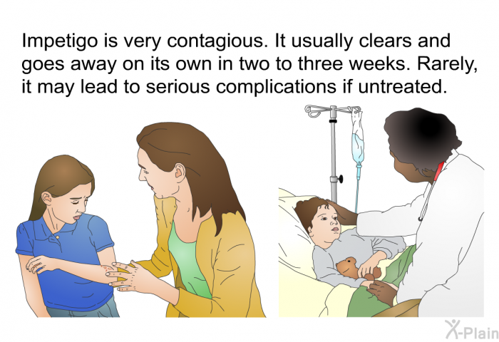 Impetigo is very contagious. It usually clears and goes away on its own in two to three weeks. Rarely, it may lead to serious complications if untreated.