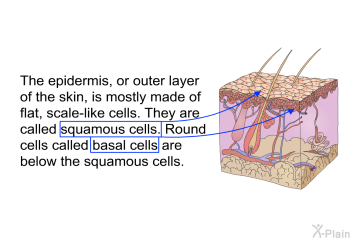 The epidermis, or outer layer of the skin, is mostly made of flat, scale-like cells. They are called squamous cells. Round cells called basal cells are below the squamous cells.