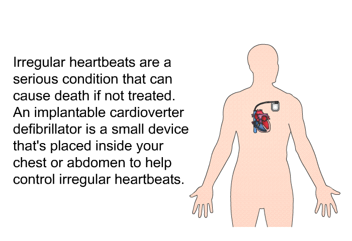 Irregular heartbeats are a serious condition that can cause death if not treated. An implantable cardioverter defibrillator is a small device that's placed inside your chest or abdomen to help control irregular heartbeats.