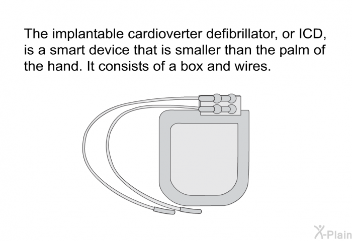 The implantable cardioverter defibrillator, or ICD, is a smart device that is smaller than the palm of the hand. It consists of a box and wires.