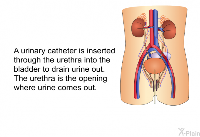 A urinary catheter is inserted through the urethra into the bladder to drain urine out. The urethra is the opening where urine comes out.