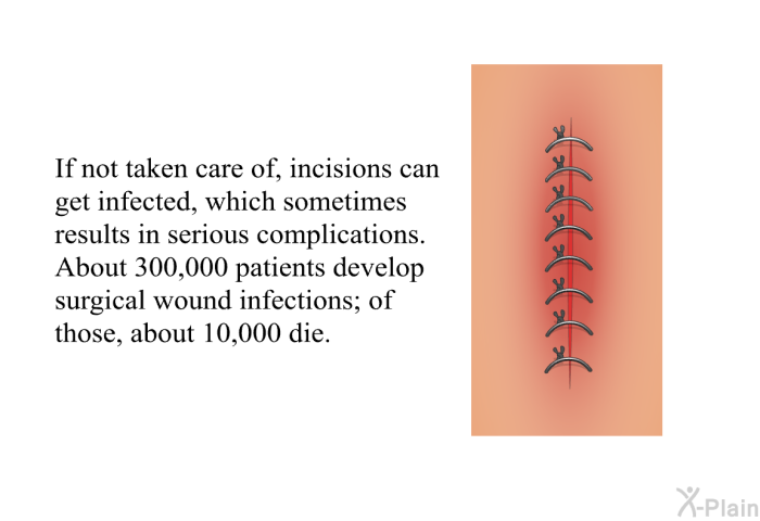 If not taken care of, incisions can get infected, which sometimes results in serious complications. About 300,000 patients develop surgical wound infections; of those, about 10,000 die.