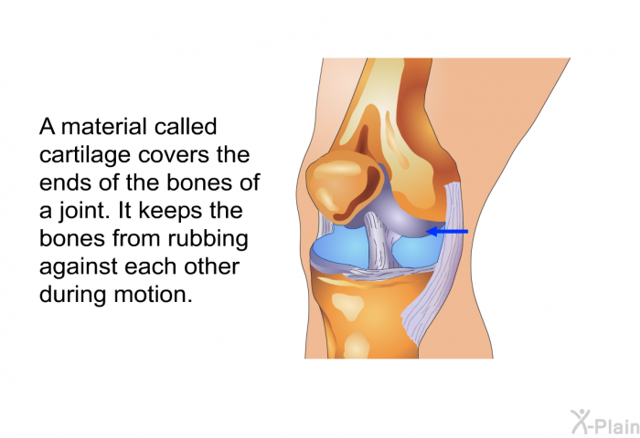 A material called cartilage covers the ends of the bones of a joint. It keeps the bones from rubbing against each other during motion.