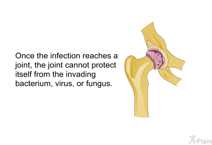 Once the infection reaches a joint, the joint cannot protect itself from the invading bacterium, virus, or fungus.