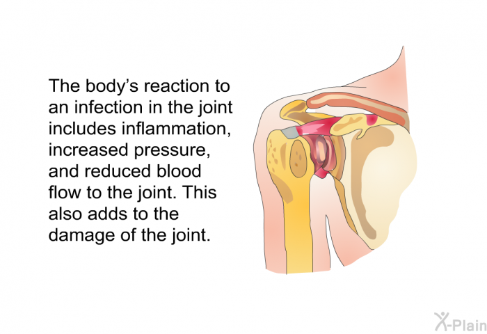The body's reaction to an infection in the joint includes inflammation, increased pressure, and reduced blood flow to the joint. This also adds to the damage of the joint.