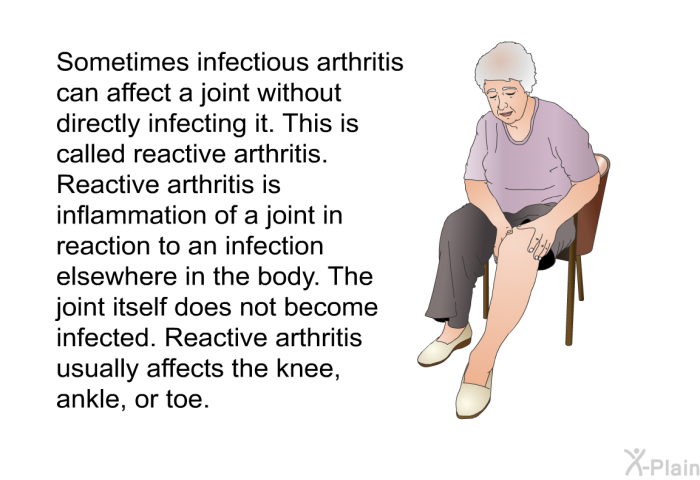 Sometimes infectious arthritis can affect a joint without directly infecting it. This is called reactive arthritis. Reactive arthritis is inflammation of a joint in reaction to an infection elsewhere in the body. The joint itself does not become infected. Reactive arthritis usually affects the knee, ankle, or toe.