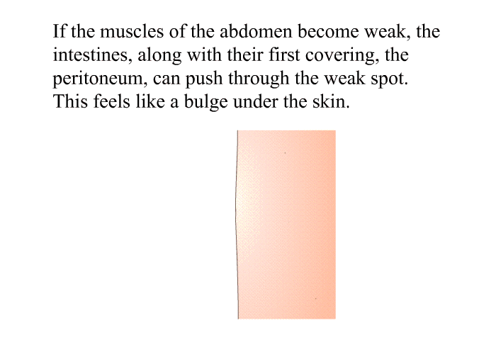 If the muscles of the abdomen become weak, the intestines, along with their first covering, the peritoneum, can push through the weak spot. This feels like a bulge under the skin.