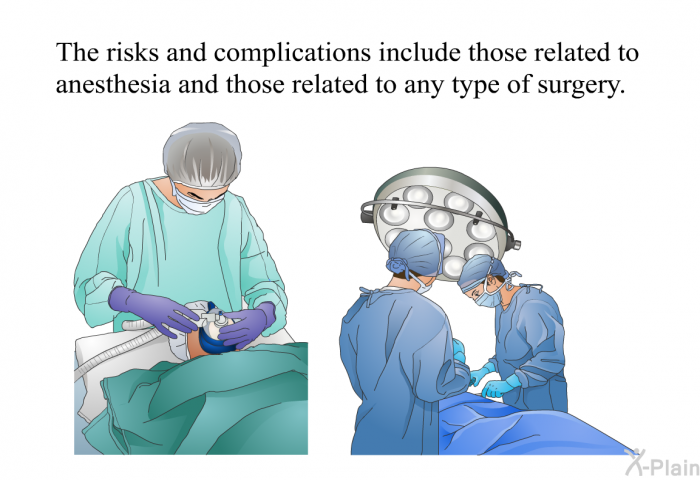 The risks and complications include those related to anesthesia and those related to any type of surgery.