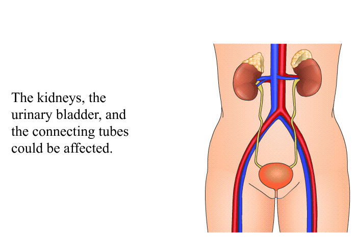 The kidneys, the urinary bladder and the connecting tubes could be affected.