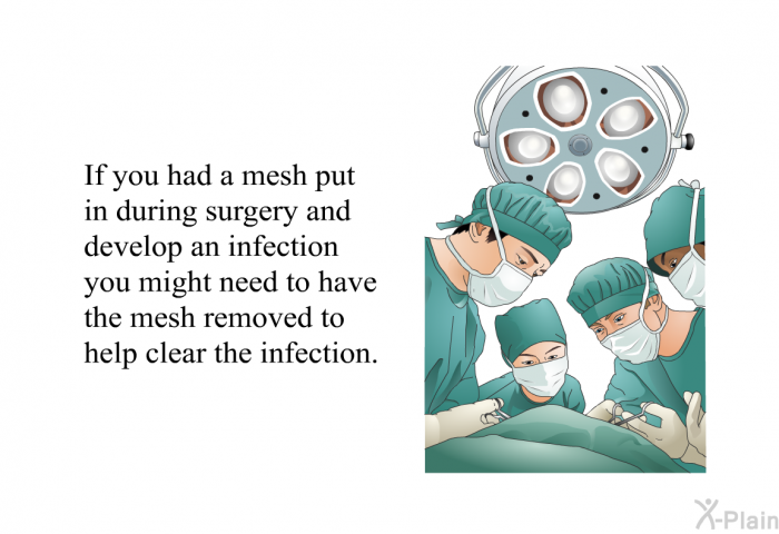 If you had a mesh put in during surgery and develop an infection you might need to have the mesh removed to help clear the infection.