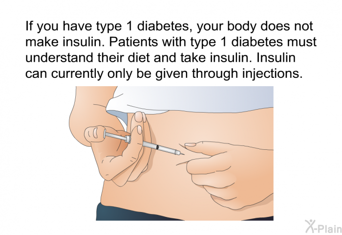 If you have type 1 diabetes, your body does not make insulin. Patients with type 1 diabetes must understand their diet and take insulin. Insulin can currently only be given through injections.