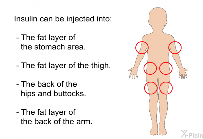 Insulin can be injected into:  The fat layer of the stomach area. The fat layer of the thigh. The back of the hips and buttocks. The fat layer of the back of the arm.