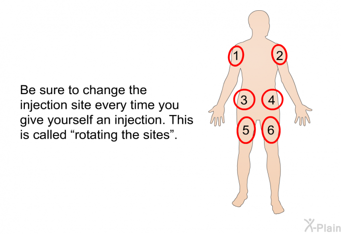 Be sure to change the injection site every time you give yourself an injection. This is called “rotating the sites”.