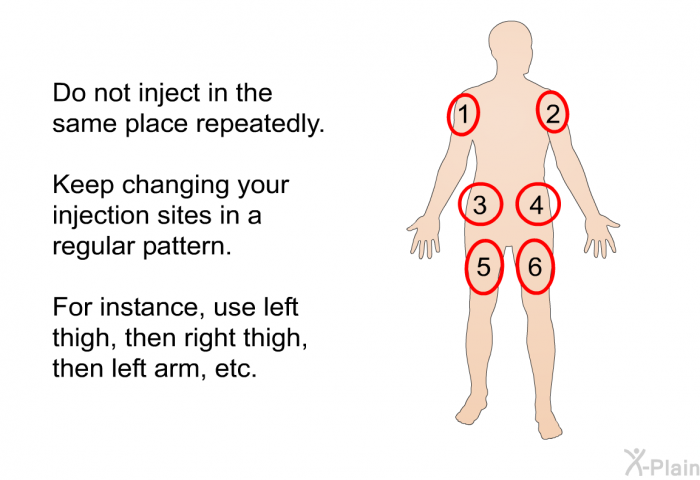 Do not inject in the same place repeatedly. Keep changing your injection sites in a regular pattern. For instance, use left thigh, then right thigh, then left arm, etc.