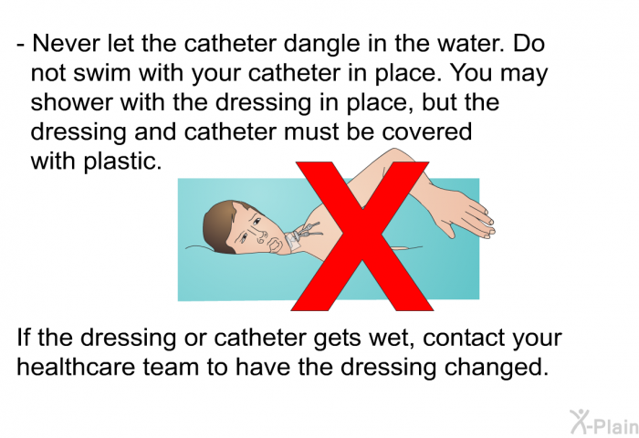 Never let the catheter dangle in the water. Do not swim with your catheter in place. You may shower with the dressing in place, but the dressing and catheter must be covered with plastic. If the dressing or catheter gets wet, contact your healthcare team to have the dressing changed.