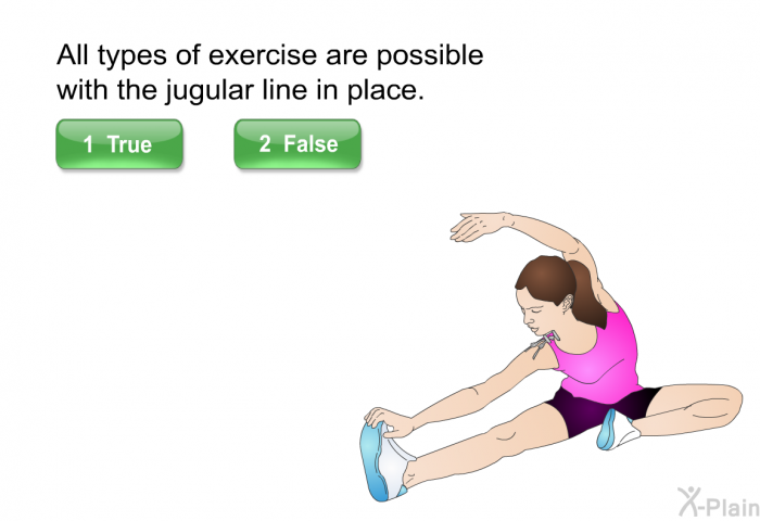 All types of exercise are possible with the jugular line in place. Press True or False.