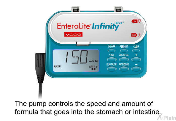 The pump controls the speed and amount of formula that goes into the stomach or intestine.
